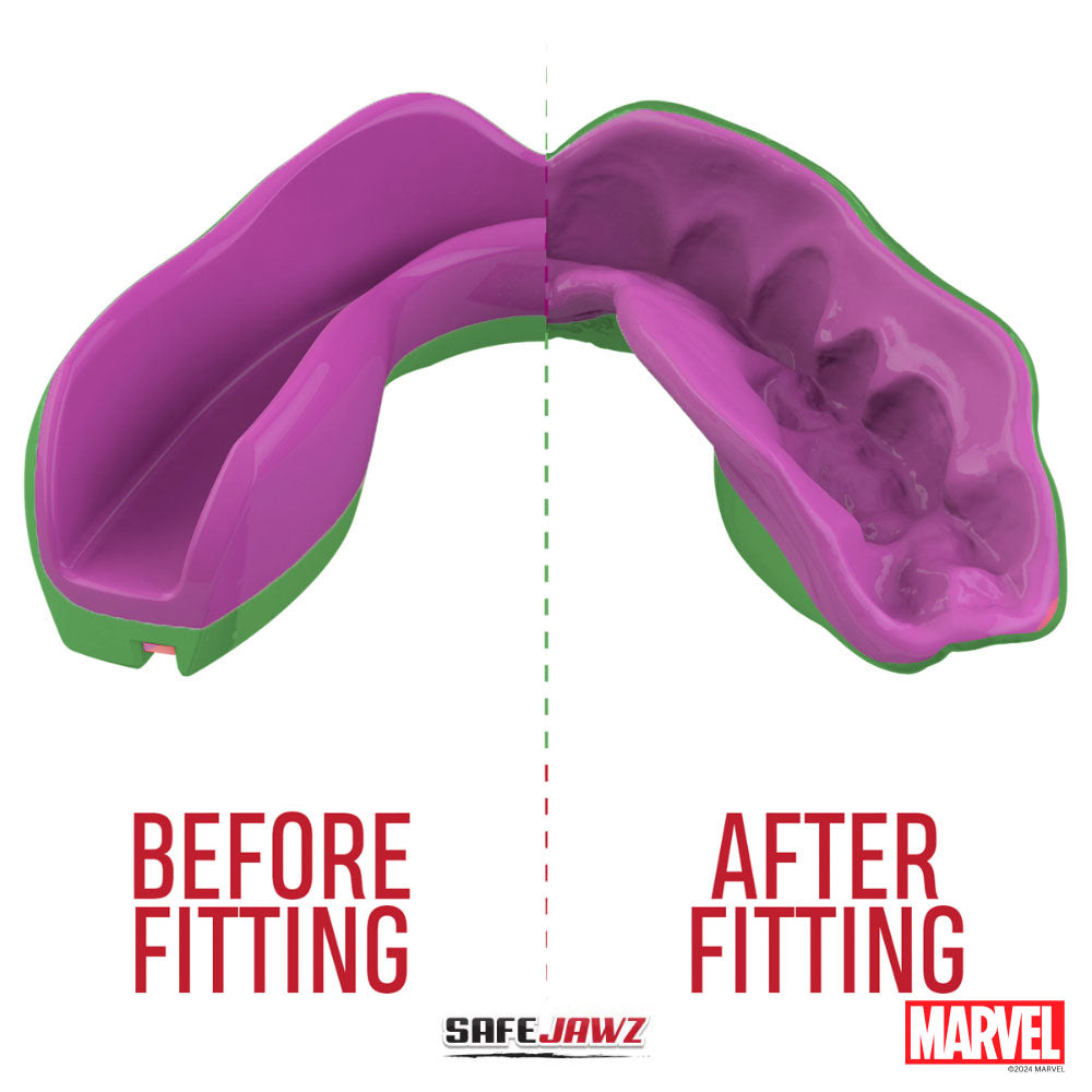 PROTECTEUR DE BOUCHE SAFEJAWZ MARVEL THE HULK